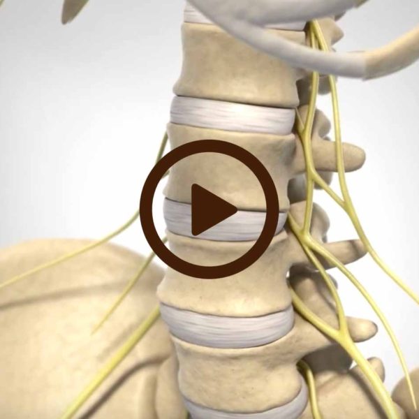 spine video Archives - Beach Orthopedic Specialty Institute