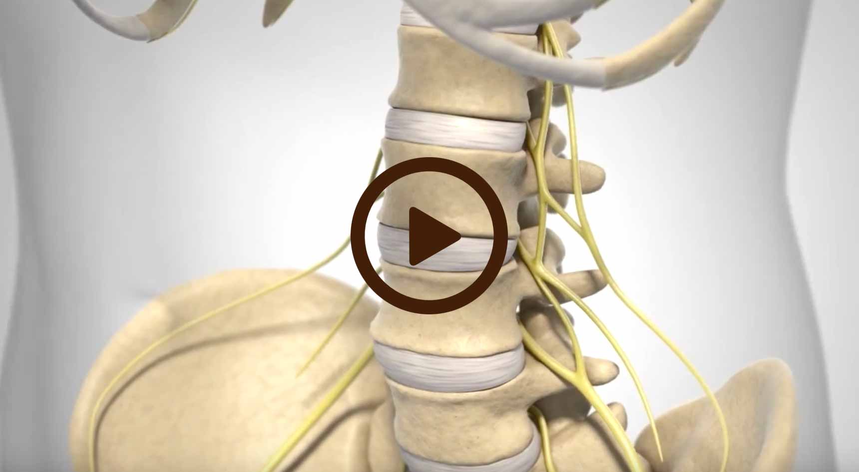 Lumbar Disc Disease